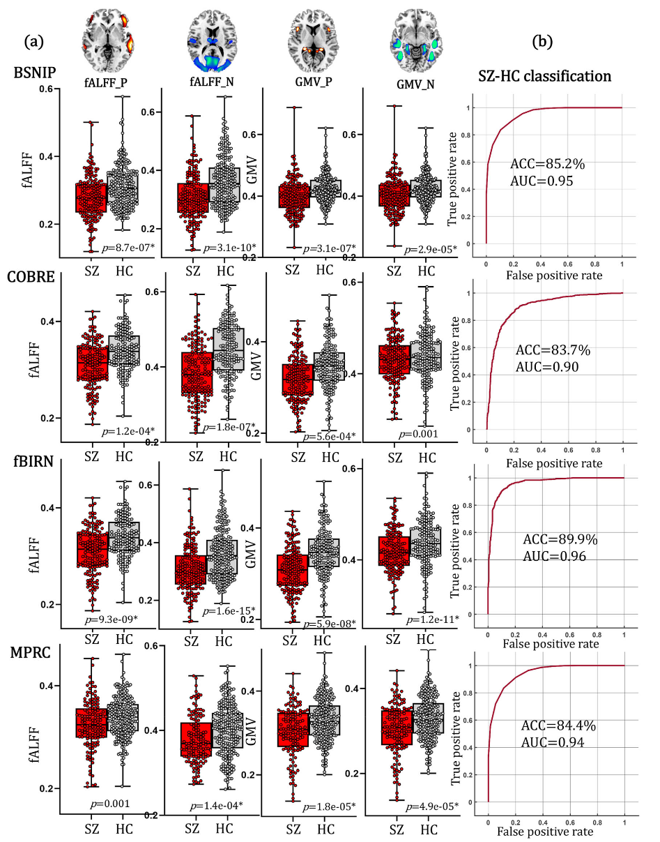 The diagnostic ability of the identified PRS-associated frontal-temporal network.