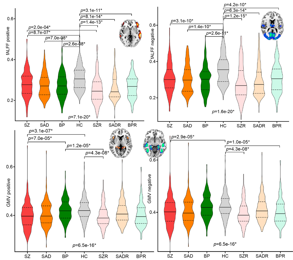 Group differences of the identified PRS-associated pattern within psychosis.