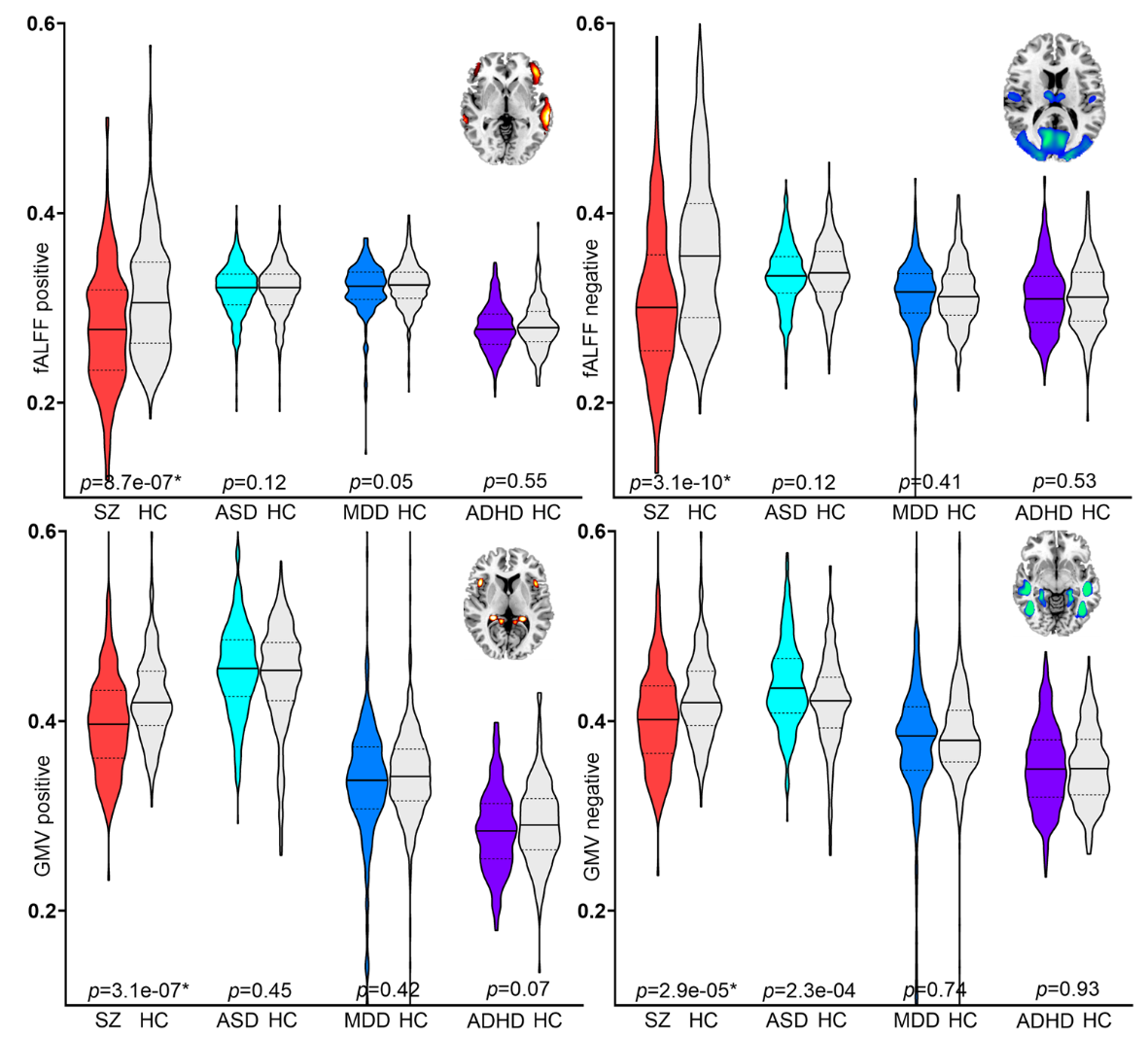 Group differences of the positive and negative PRS-associated networks between SZ and HC, between ASD and HC, between MDD and HC, between ADHD and HC.